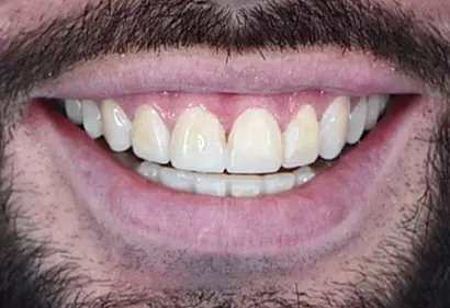 Фото отзыва