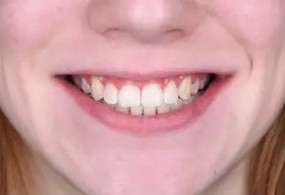 Фото отзыва