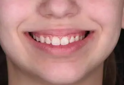 Фото отзыва