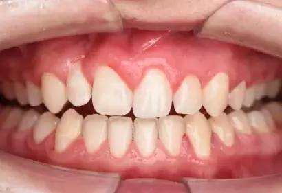 Фото отзыва