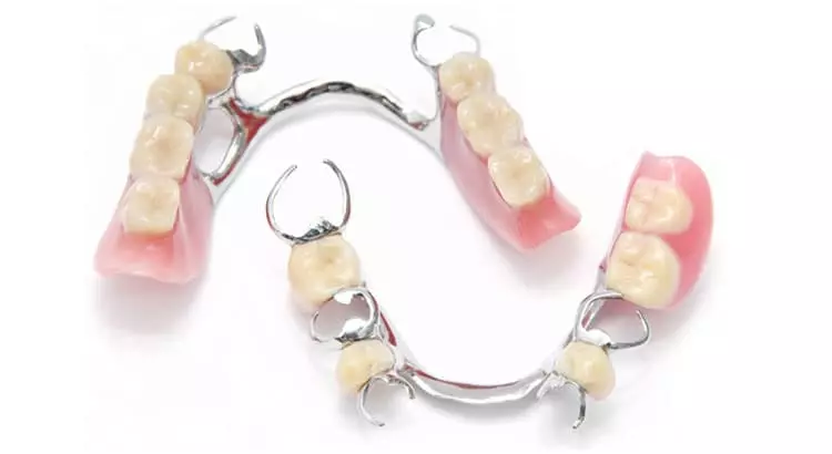 removable-partial-dentures-with-claps.jpg