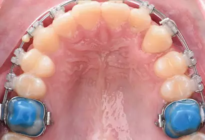 Фото отзыва