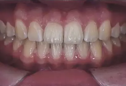 Фото отзыва