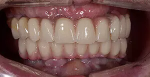 Фото отзыва