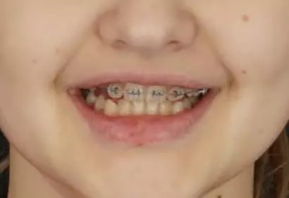 Фото отзыва