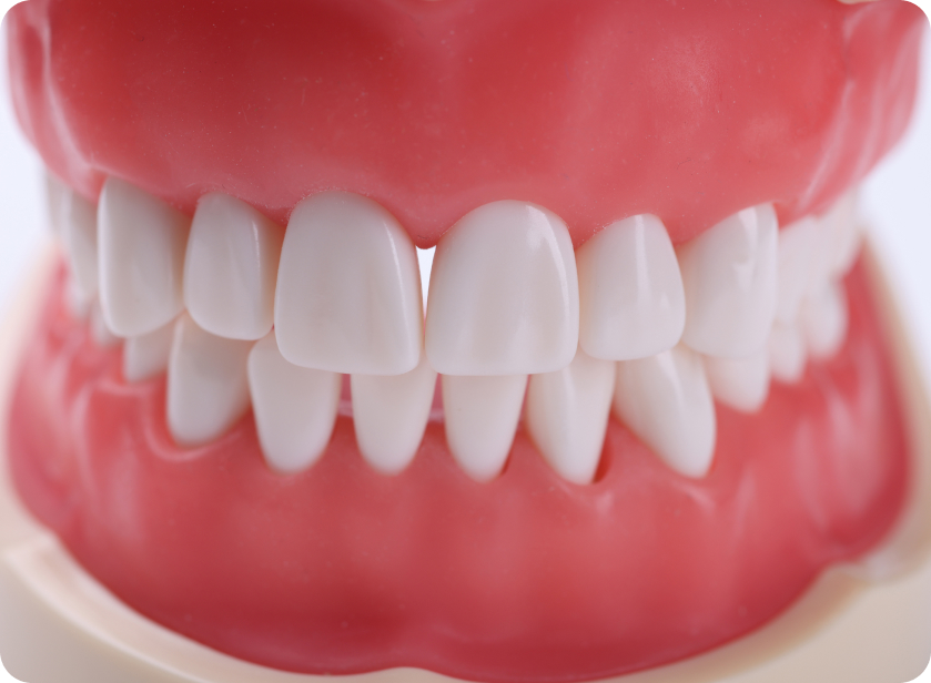 Гингивит — что это значит, как лечат?