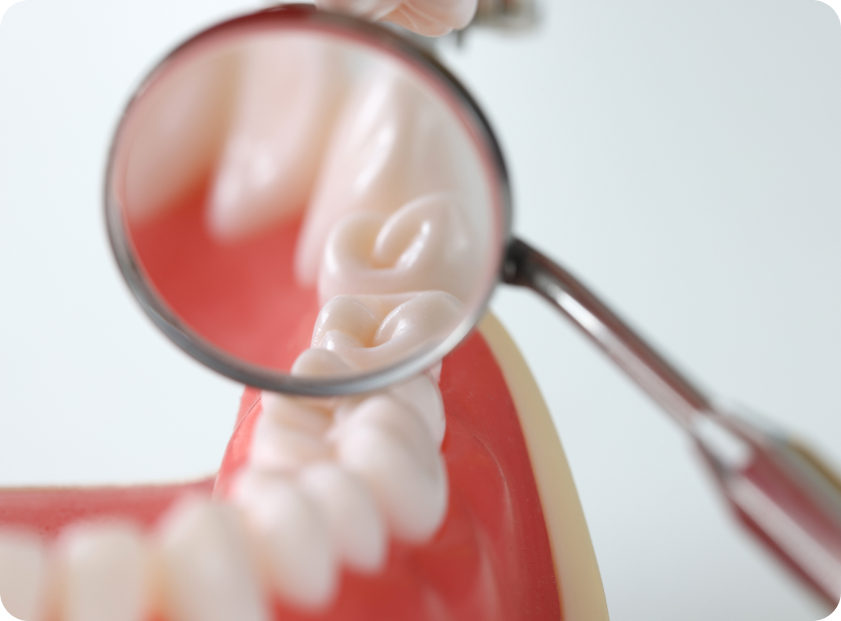 Почему под пломбой болит зуб?