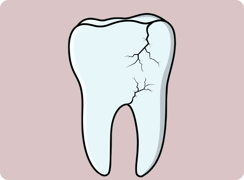 Почему крошатся зубы?