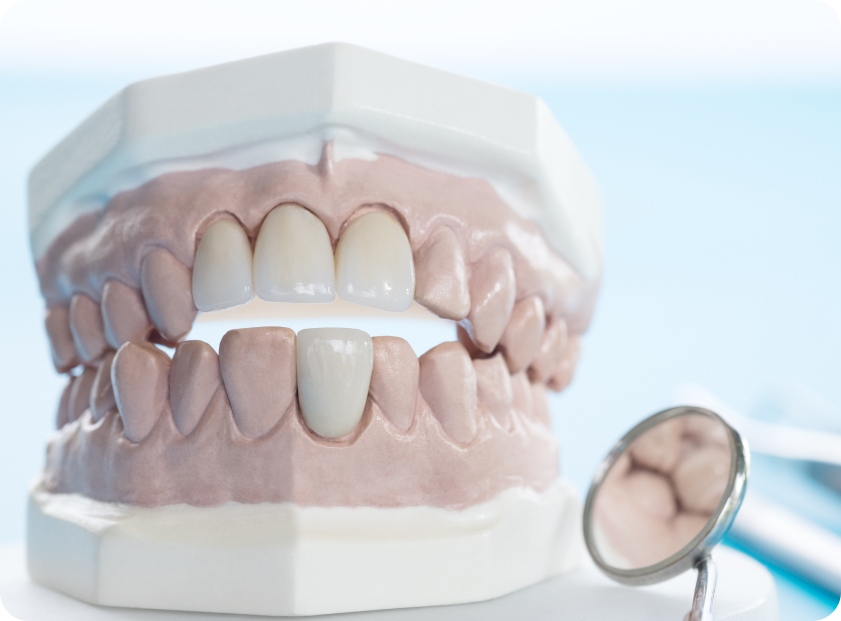 Болит зуб под мостом